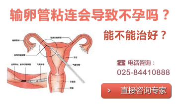 �Ͼ��������ѹ�ճ������Ǯ